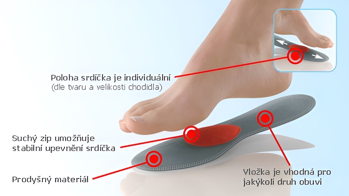 Hallufix - ortopedická vložka s posuvným srdíčkem