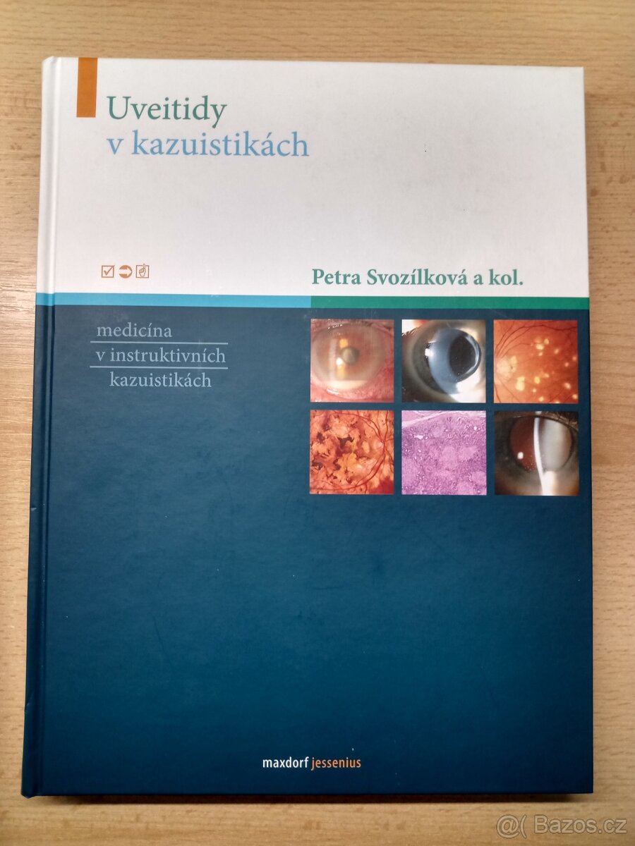 Uveitidy v kazuistikách