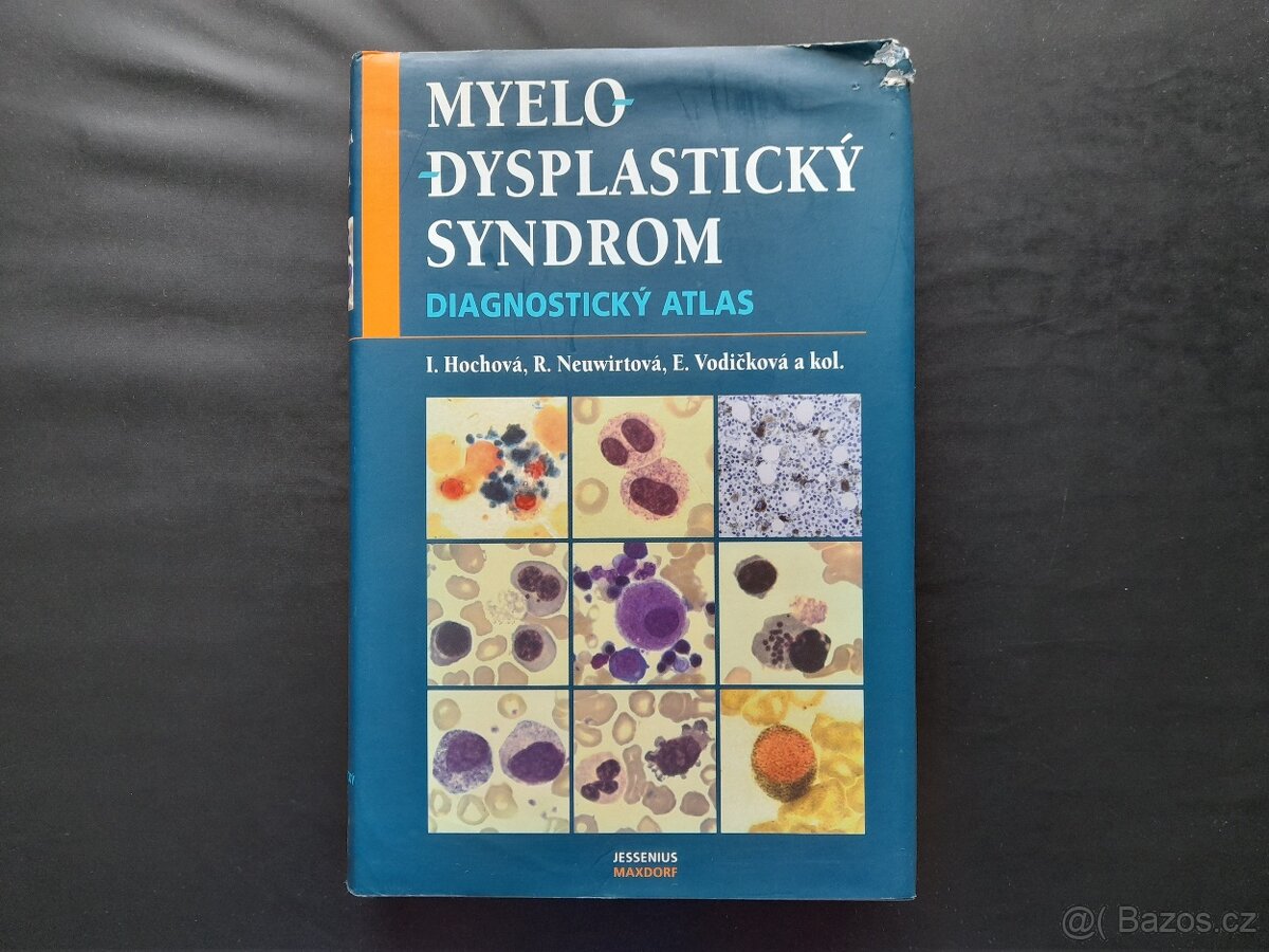 Myelodysplastický syndrom