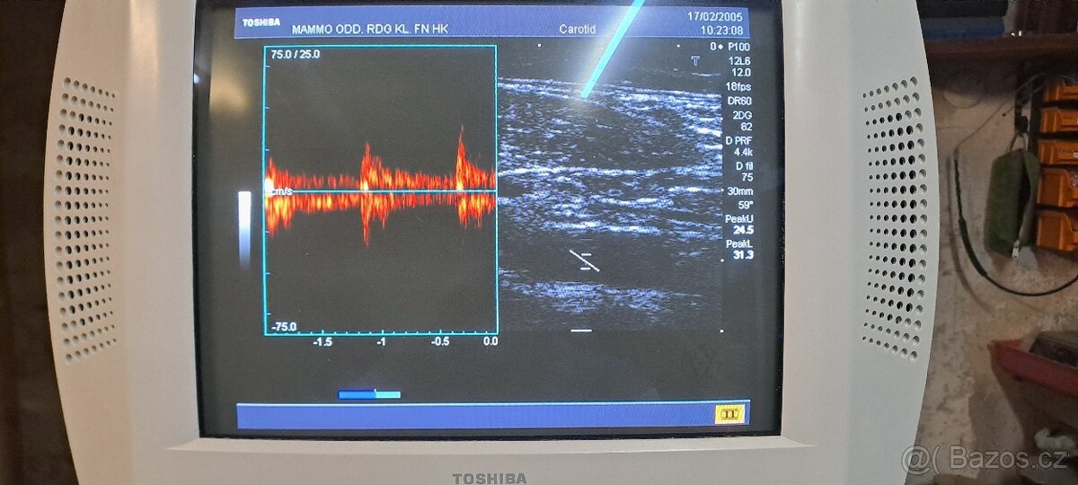 Ultrazvuk/sonograf Toshiba Nemio
