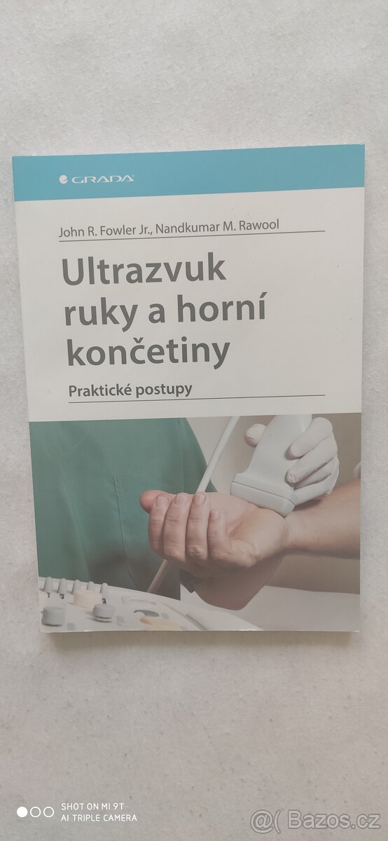 Ultrazvuk ruky a horní končetiny -Fowler ,Rawool