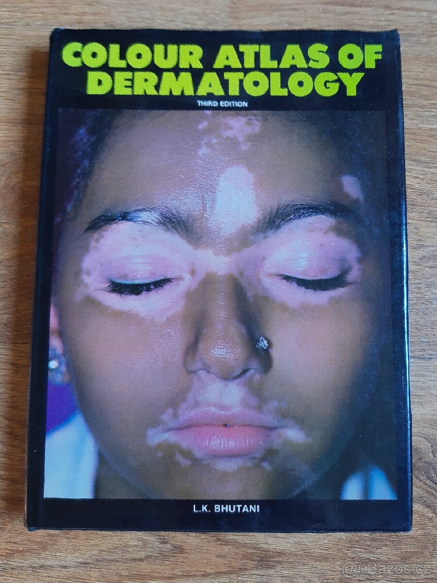Colour atlas of dermatology