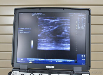 Ultrazvukový přístroj GE Logiq E 2013 4C-RS, 12L-RS, Sony UP - 11