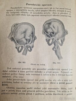 Bylinkářství  1900?  Kniha o domacím léčení velmi používaná. - 11