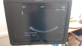 HITACHI ALOKA ARIETTA v70 - 12