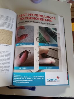 Hyperbarická medicína - 13