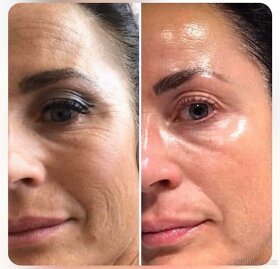 AKCE NuSkin - AgeLOC Boost + sérum - 14