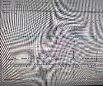 Herní PC sestava R7 5800X X570 64GB 1TB RTX 4060 DPH - 15