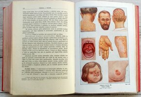 Nový lékařský rádce, starožitná lékařská kniha ze 20. let - 15