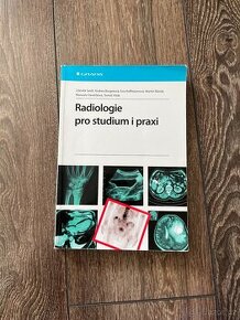 Radiologie pro studium i praxi - 1