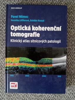Optická koherenční tomografie