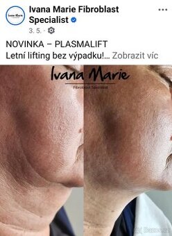 Poukázka plasmalift
