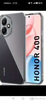 Honor 400