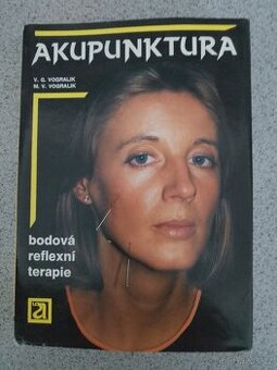 Akupunktura - 1