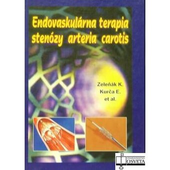 Endovaskulárna terapia stenózy arteria carotis - Kamil Zeleň