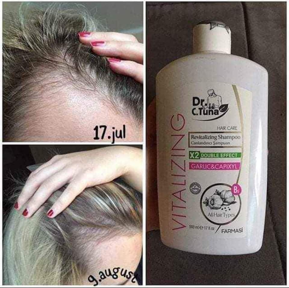 Farmasi. Česnekovy šampon pro růst a obnovu vlasů - 2