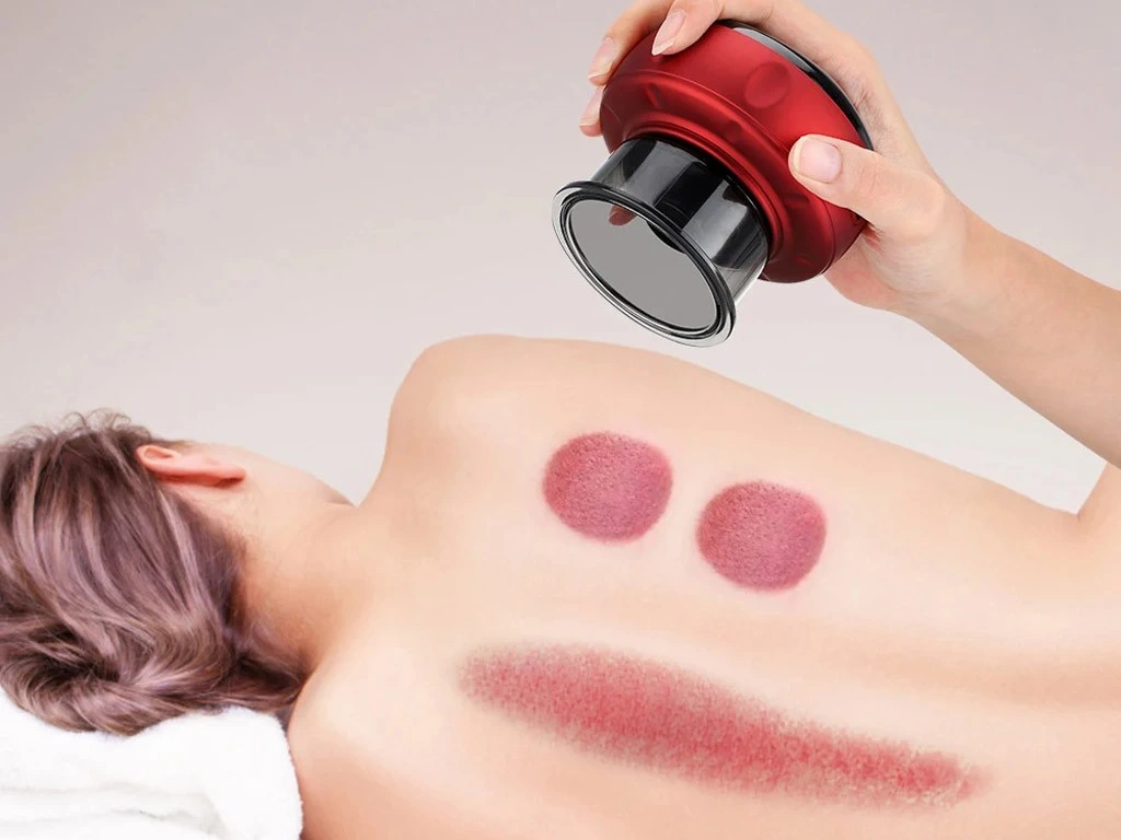 Elektrická vakuová masážní baňka - 2