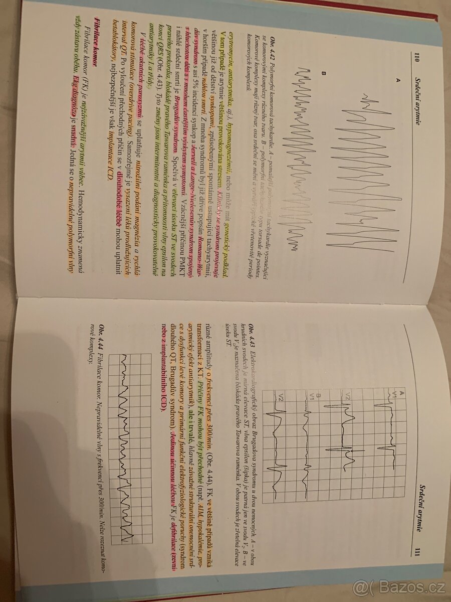 Klinická kardiologie stručně Jan Lukl - 2
