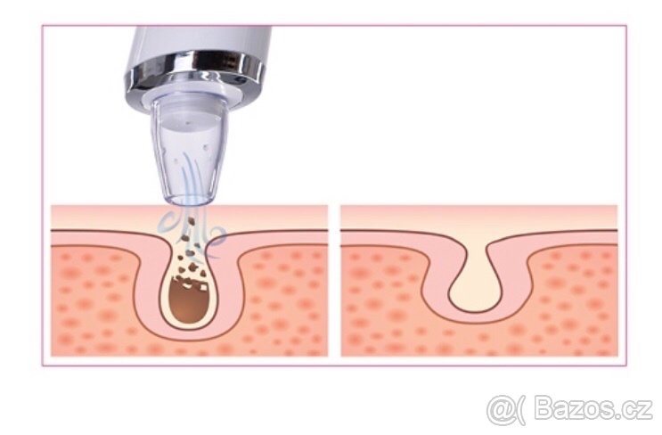 Přístroj k čištění pleti - 2