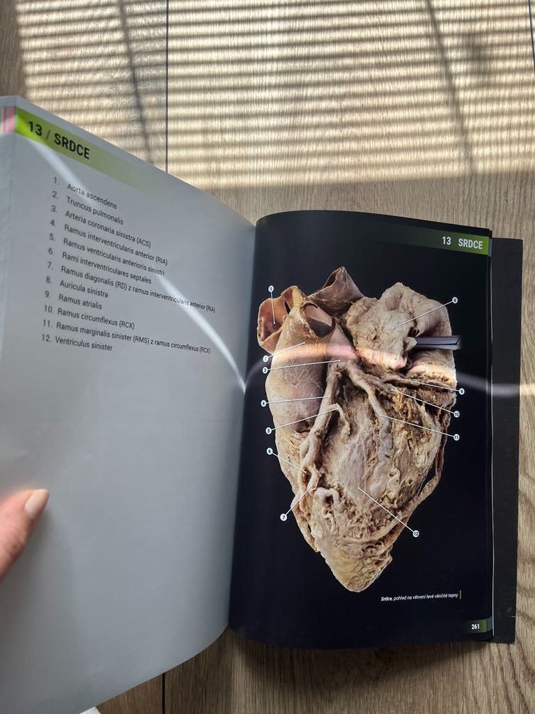 Atlas vybraných kapitol anatomie člověka - 2