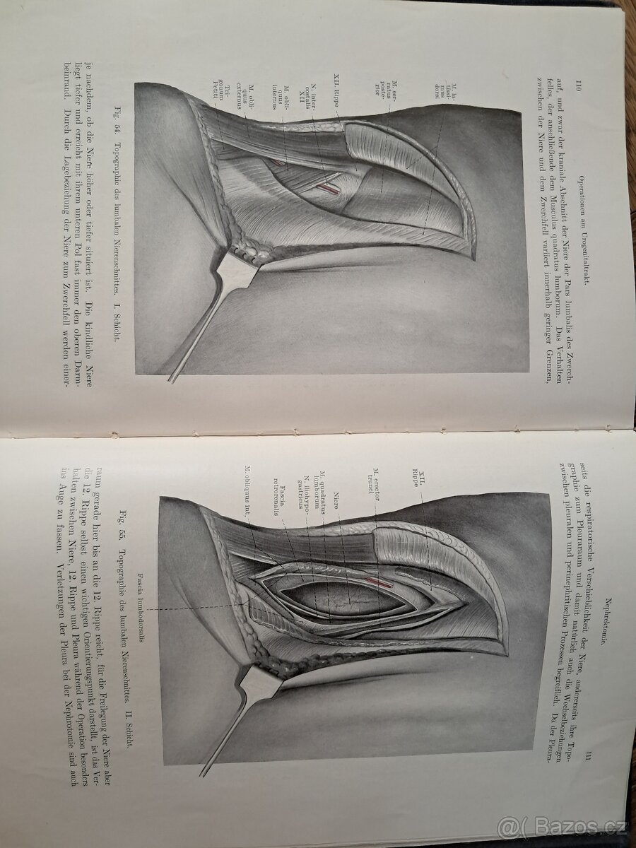 Topographische anatomie dringlicher operationen - 2