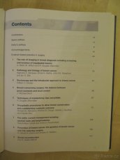 Breast surgery - 4th edition NOVÁ kniha - 2