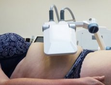 Novinka 2023: DuoWings - bezkontaktní liposukce - 2