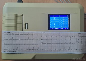 EKG přímopíšící - 2