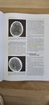 Speciální chirurgie 2. Vydání - 2