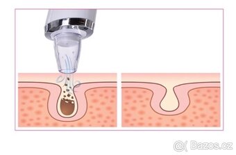 Vakuový čistič pleti - 2