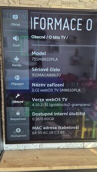 LG TV 75SM8610PLA - 2