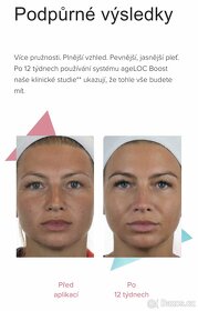 AgeLOC Boost + sérum - 2