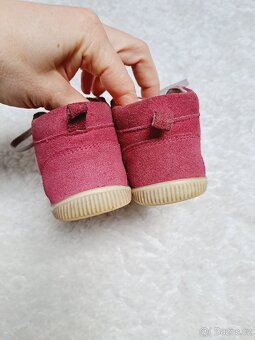 Kožené boty protetika baby Fuxia, vel. 22 - 2