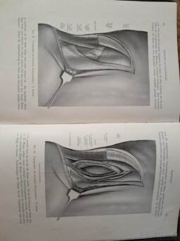 Topographische anatomie dringlicher operationen - 2