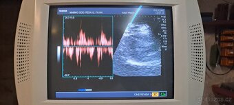 Ultrazvuk/sonograf Toshiba Nemio - 2