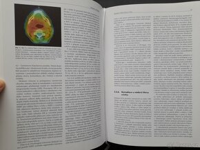 Onkologie knihy - 2