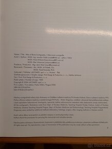 Atlas kostní scintigrafie - 2