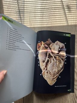 Atlas vybraných kapitol anatomie člověka - 2