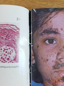 Colour atlas of dermatology - 2