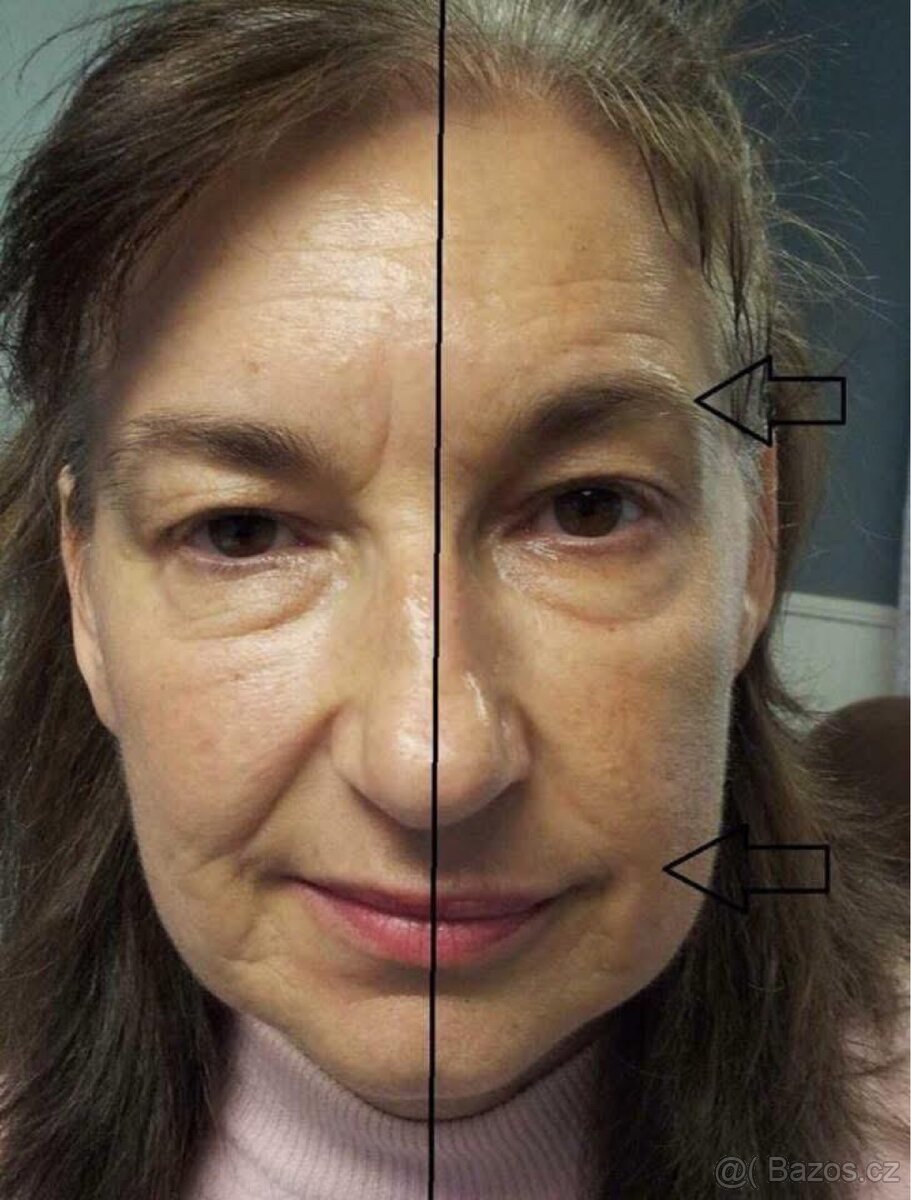 AKCE NuSkin - AgeLOC Line Corektor - 3