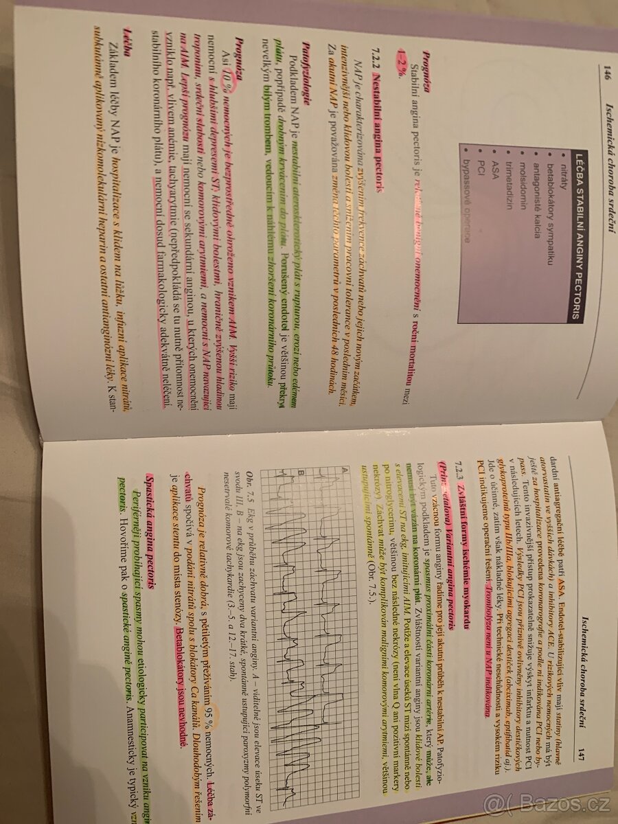 Klinická kardiologie stručně Jan Lukl - 3