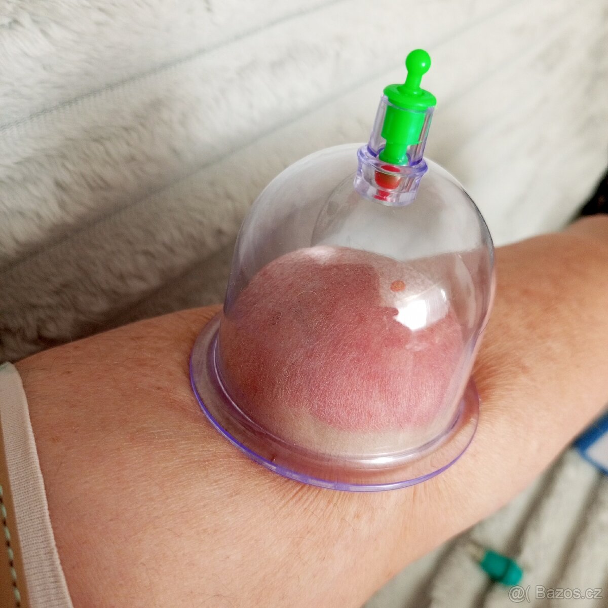 Sada na baňkování. - 3