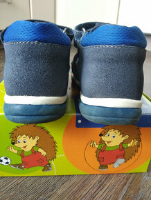 Sandálky protetika - 3