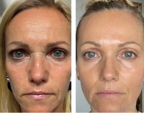 Collagen + Vitamin C sérum pumps - 3
