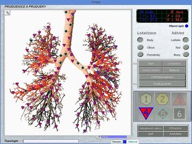 Oberon Quantum diagnostický biorezonanční přístroj PC165000 - 3