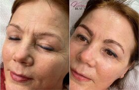 Galvanic Spa sada na galvanizaci AKCE - 3