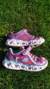 Skechers tenisky 29 - 3