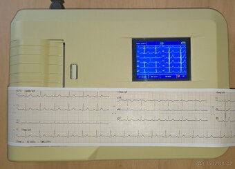 EKG přímopíšící - 3