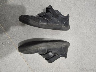 Baby Bare, černé - 3