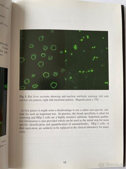 Atlas HEp-2 patterns - 3